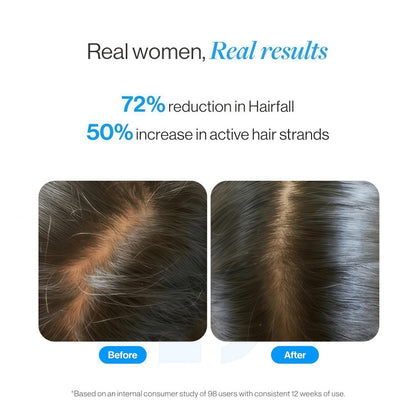 Advanced Hair Growth Serum